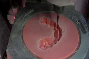 ƵݼӹZWDental 2013ԤƬ