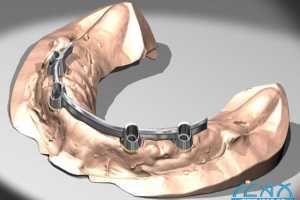 Delcam˾չ־׼CADCAMϵͳ