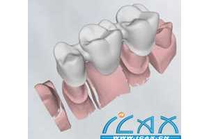 Delcam ڰ̳չʾCADCAMɹ