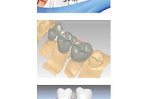 רҵƹҵ Delcam DentCAD 8.0 