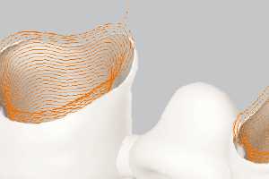 [OPEN MIND]  HYPERDENT