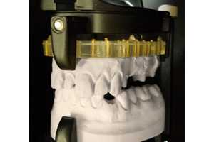 Delcam ȫרɨ DentSCAN