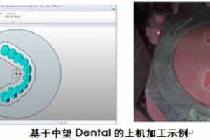 DentalõCAD/CAM
