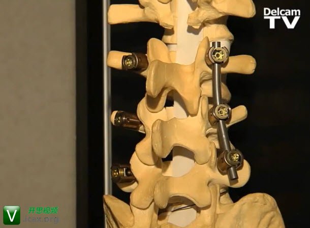 Acero Precision PartMaker.jpg